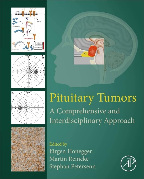 Pituitary Tumors : A Comprehensive and Interdisciplinary Approach - Ha image 1
