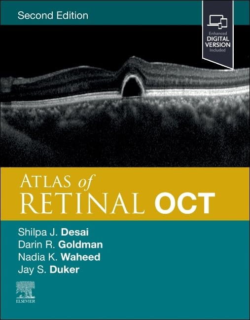 Atlas of Retinal OCT : Optical Coherence Tomography - Hardback image 1