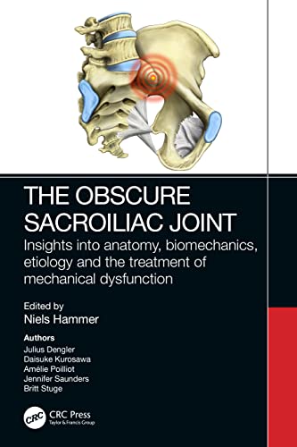 Obscure Sacroiliac Joint : Insights into anatomy, biomechanics, etiolo