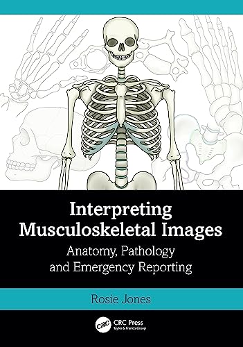 Rosie Jones - Interpreting Musculoskeletal Images : Anatomy, Pathology image 1