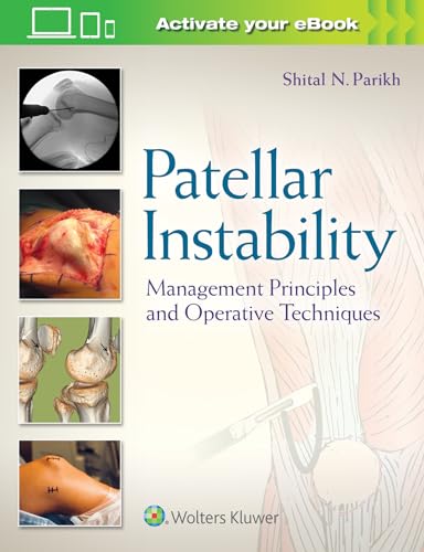 Patellar Instability : Management Principles and Operative Techniques image 1