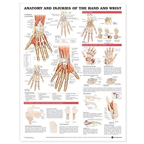 Anatomy and Injuries of the Hand and Wrist Anatomical Chart - Map