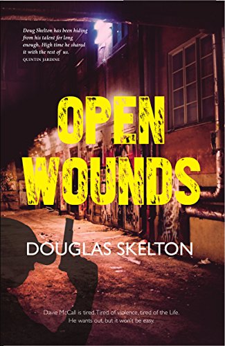 Douglas Skelton - Open Wounds : 4 - Paperback image 1