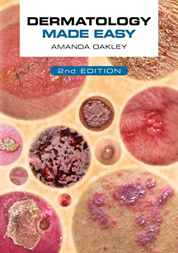 Amanda Oakley - Dermatology Made Easy, second edition - Paperback image 1