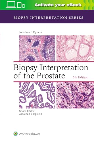 Jonathan I. Epstein - Biopsy Interpretation of the Prostate - Hardback image 1