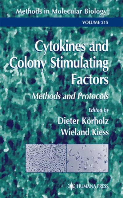 Cytokines and Colony Stimulating Factors: Methods and Protocols