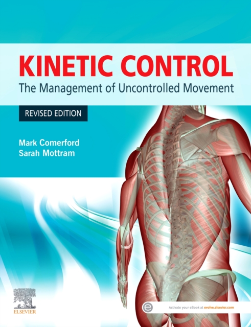 Kinetic Control : The Management of Uncontrolled Movement