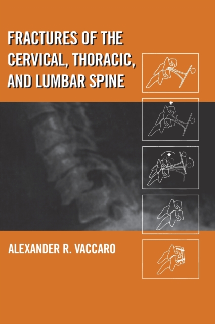 Fractures of the Cervical, Thoracic, and Lumbar Spine