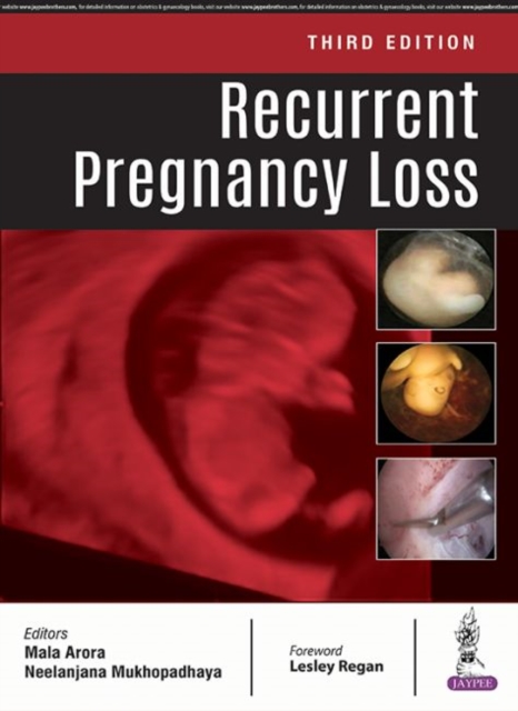 Recurrent Pregnancy Loss