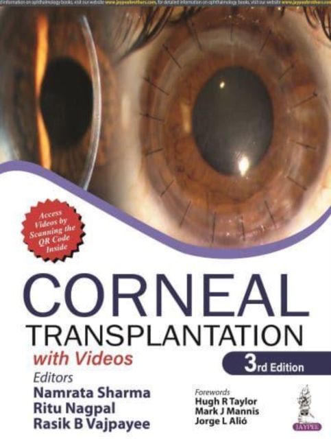 Corneal Transplantation : with Videos