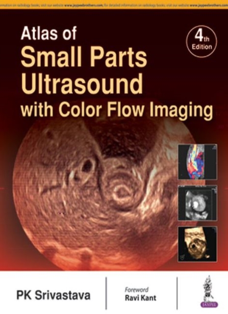 Atlas of Small Parts Ultrasound : with Color Flow Imaging