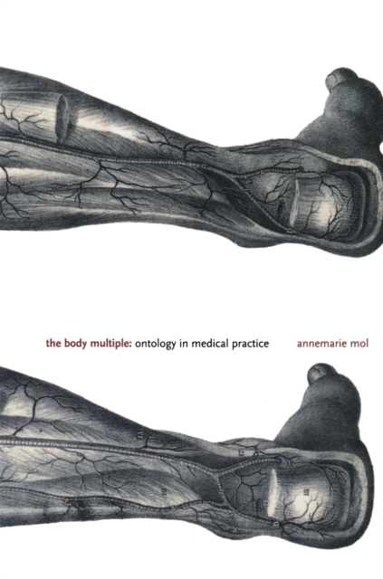 The Body Multiple : Ontology in Medical Practice