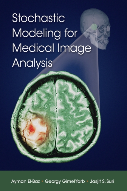 Stochastic Modeling for Medical Image Analysis