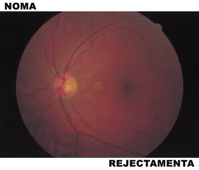 Noma - Split - Used CD image 1